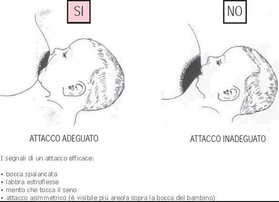 Scopri qual è il miglior modo per attaccare il tuo bimbo e migliorare così l'allattamento al seno